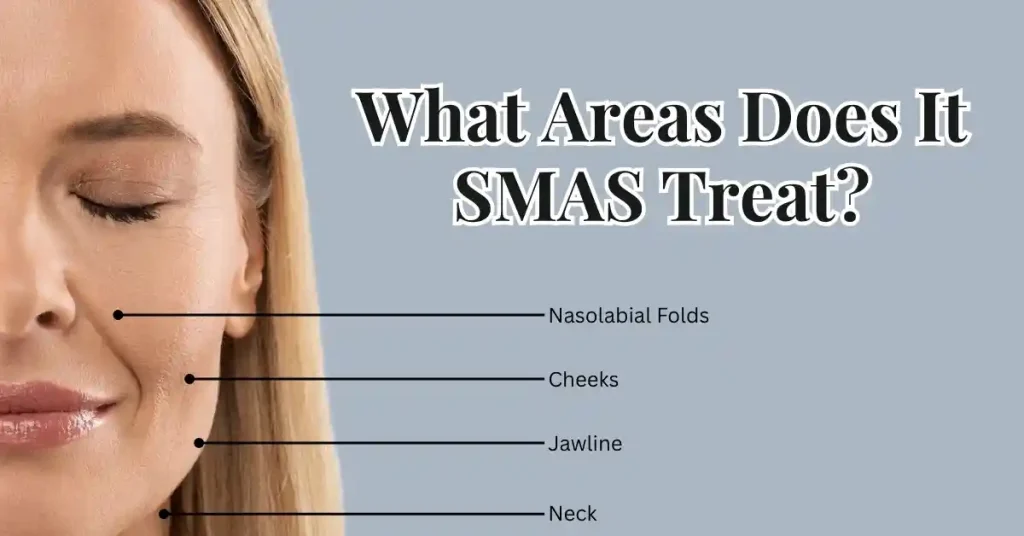 smas facelift