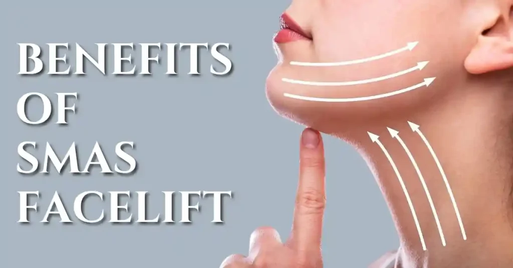 smas facelift