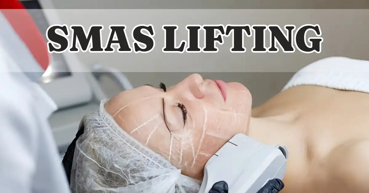 smas lifting