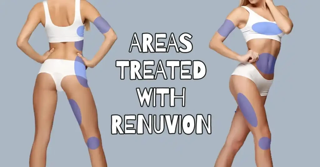 renuvion near me