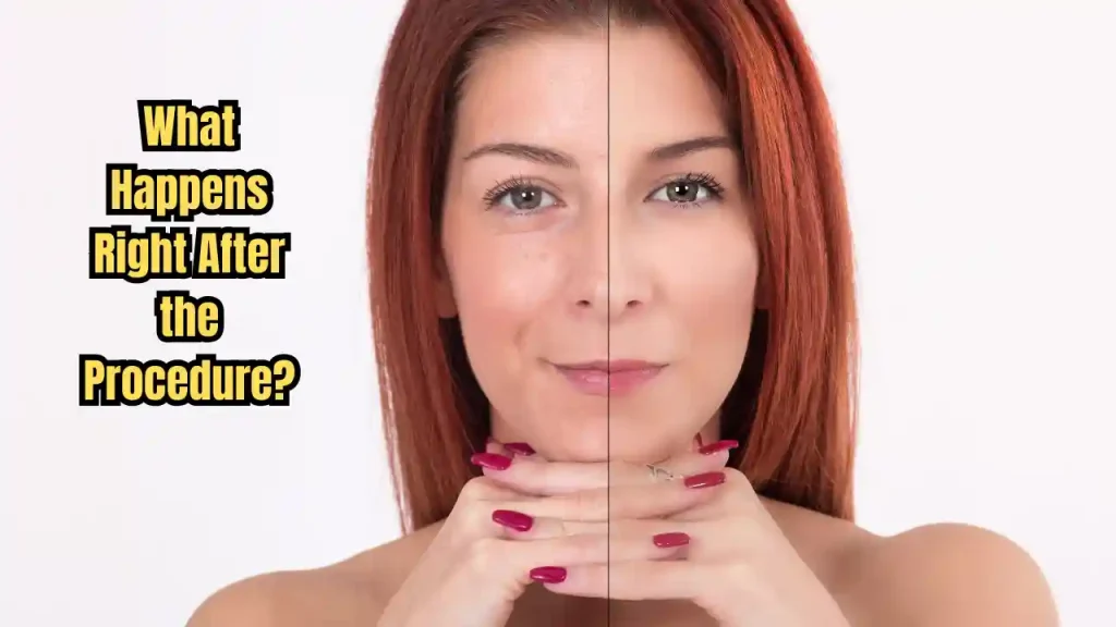 j plasma liposuction