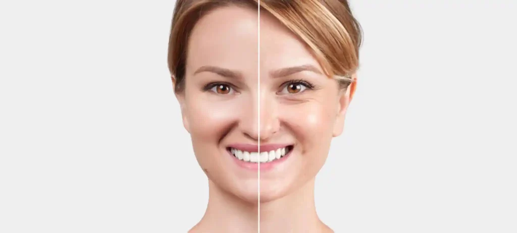 botox santa ana ca