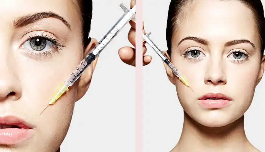 botox santa ana ca