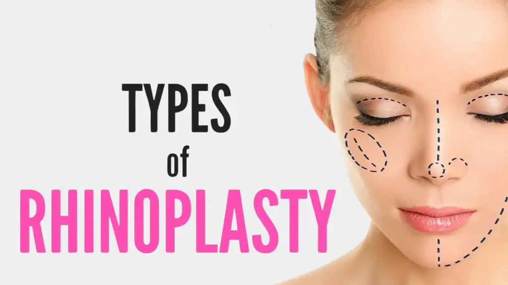best nose job surgeon in chicago