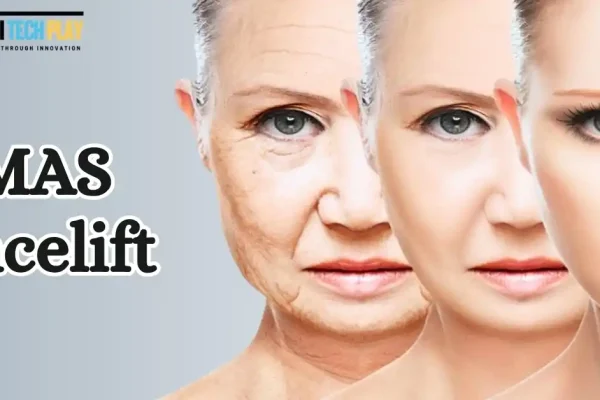 smas facelift