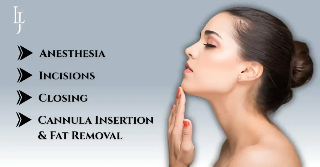 neck liposuction nyc