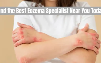 eczema specialist near me