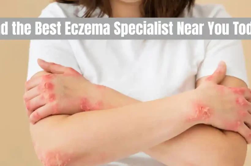 eczema specialist near me