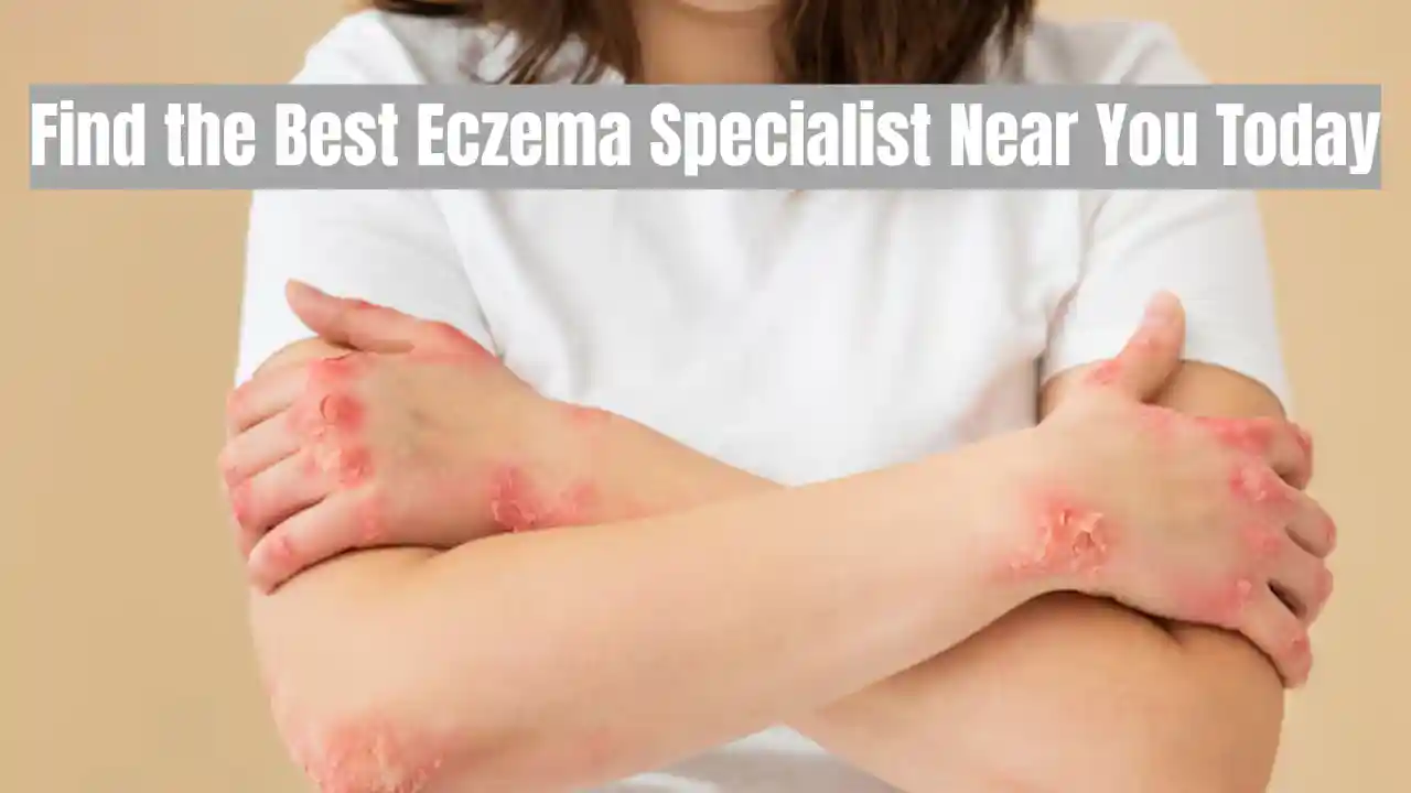 eczema specialist near me