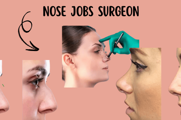 Finding the Best Nose Jobs Surgeon Near Me: A Comprehensive Guide