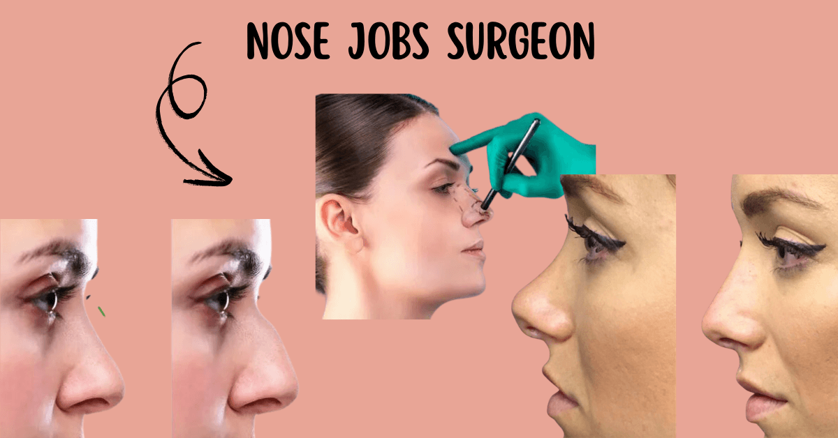 Finding the Best Nose Jobs Surgeon Near Me: A Comprehensive Guide