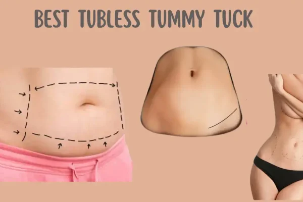 Best Tubeless Tummy Tuck in New York Best Tubeless Tummy Tuck in New York